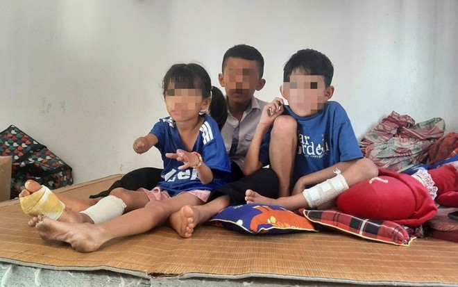 Sức khoẻ của 3 nạn nhân nhỏ tuổi trong vụ nổ kinh hoàng tại Nghệ An sau hơn 1 tháng điều trị - Ảnh 1.