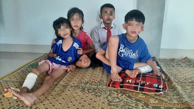 Sức khoẻ của 3 nạn nhân nhỏ tuổi trong vụ nổ kinh hoàng tại Nghệ An sau hơn 1 tháng điều trị - Ảnh 5.