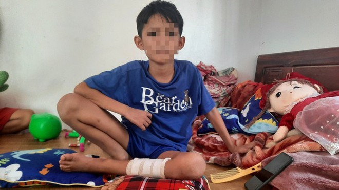 Sức khoẻ của 3 nạn nhân nhỏ tuổi trong vụ nổ kinh hoàng tại Nghệ An sau hơn 1 tháng điều trị - Ảnh 3.