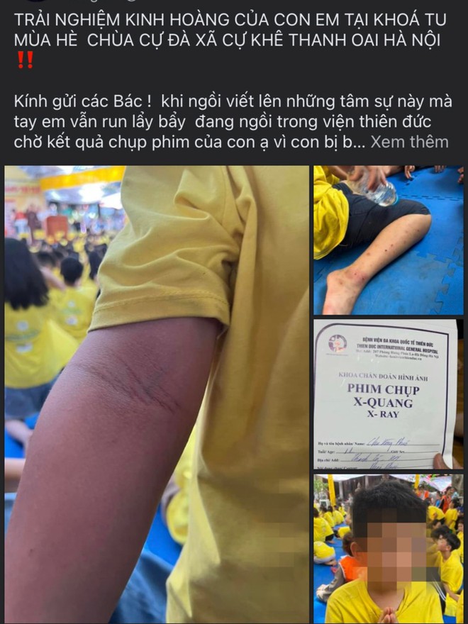 Tr&iacute;ch xuất camera, x&aacute;c minh vụ b&eacute; trai bị đ&aacute;nh khi tham gia kho&aacute; tu ở ch&ugrave;a Cự Đ&agrave; - Ảnh 2.
