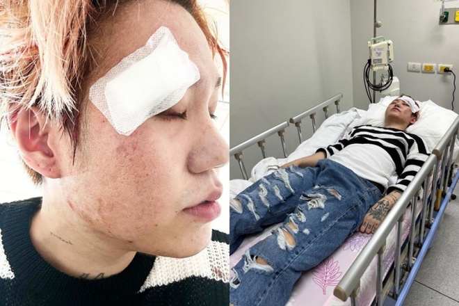 Nam ca sĩ l&ecirc;n cơn co giật, nhập viện khẩn ở Th&aacute;i Lan - Ảnh 2.