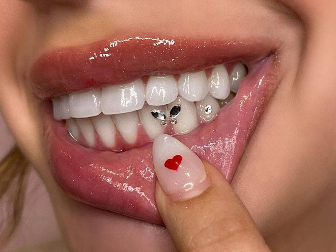 Xu hướng đính đá vào răng: Bác sĩ khuyến cáo điều quan trọng khi làm - Ảnh 2.