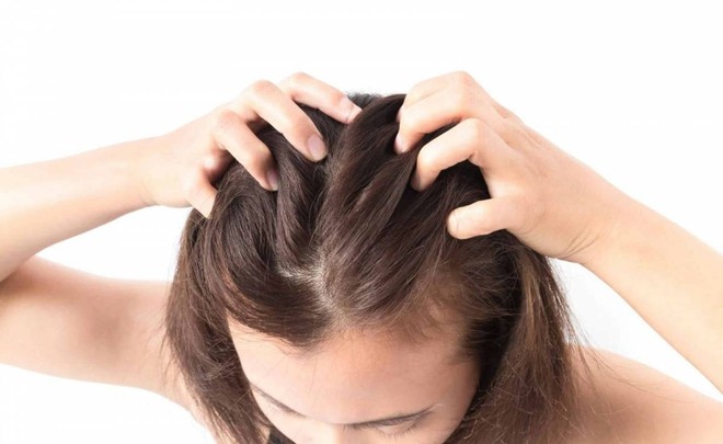 H&agrave;nh t&acirc;y gi&uacute;p giảm rụng t&oacute;c hiệu quả - Ảnh 3.