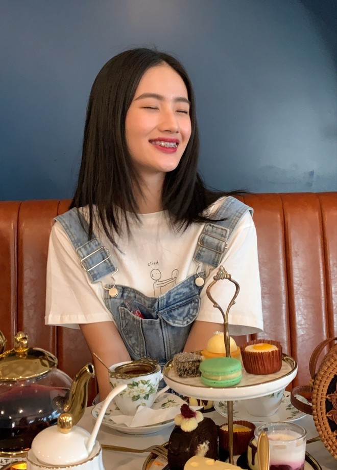 Ảnh thời c&ograve;n niềng răng của t&acirc;n Hoa hậu Huỳnh Trần &Yacute; Nhi - Ảnh 1.