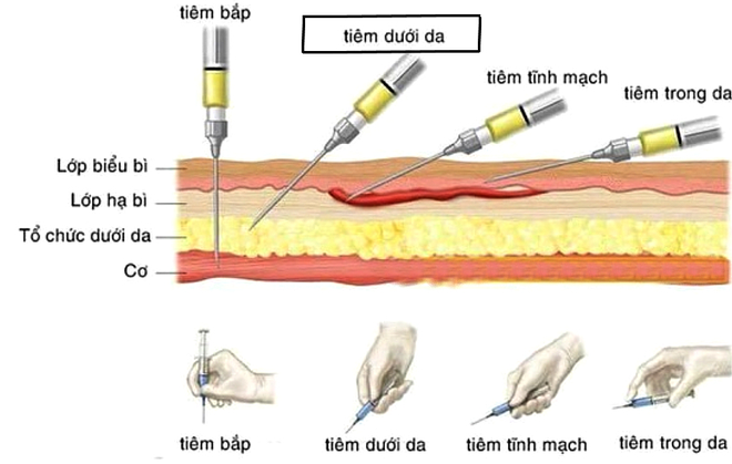 Bác sĩ da liễu lý giải vì sao tiêm meso…