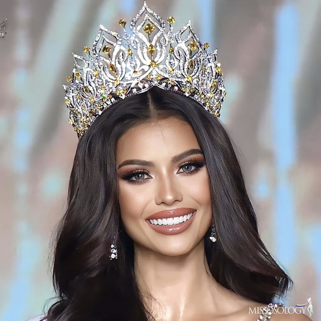 Lộ ảnh quá khứ của tân Miss Universe Thái Lan, nhan sắc thế nào mà netizen khó lòng nhận ra? - Ảnh 2.
