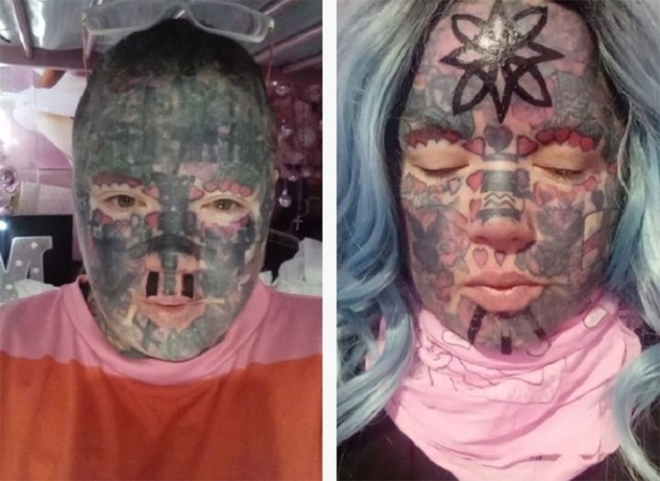 C&ocirc; g&aacute;i bị m&ugrave; sau khi xăm mắt - Ảnh 3.