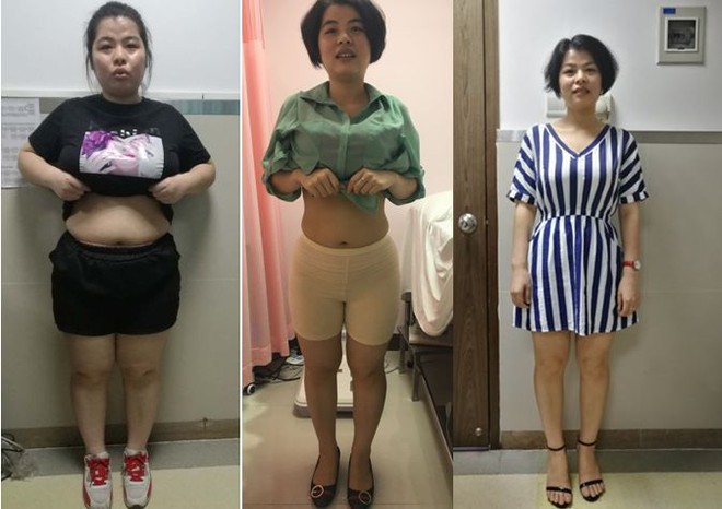 Từng nặng 83kg, c&ocirc; g&aacute;i trẻ giảm ngoạn mục 25kg: B&iacute; quyết kh&ocirc;ng phải nhịn ăn m&agrave; l&agrave; ăn nhiều 1 thứ - Ảnh 1.