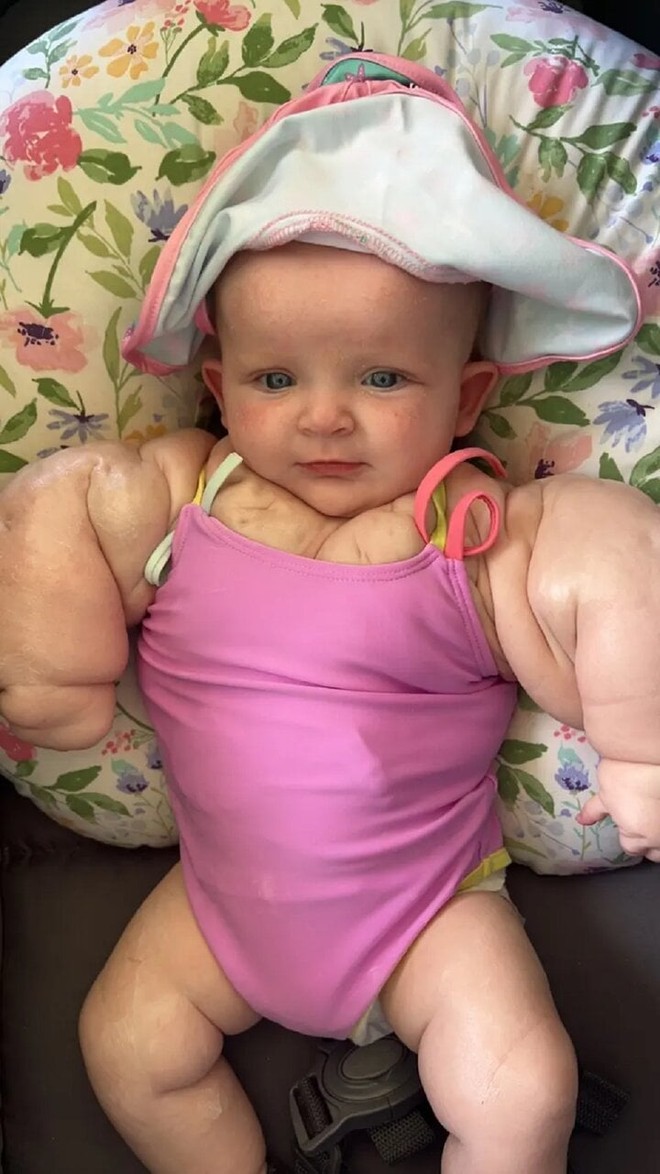 9-month-old baby girl has the body of a bodybuilder - Photo 2.