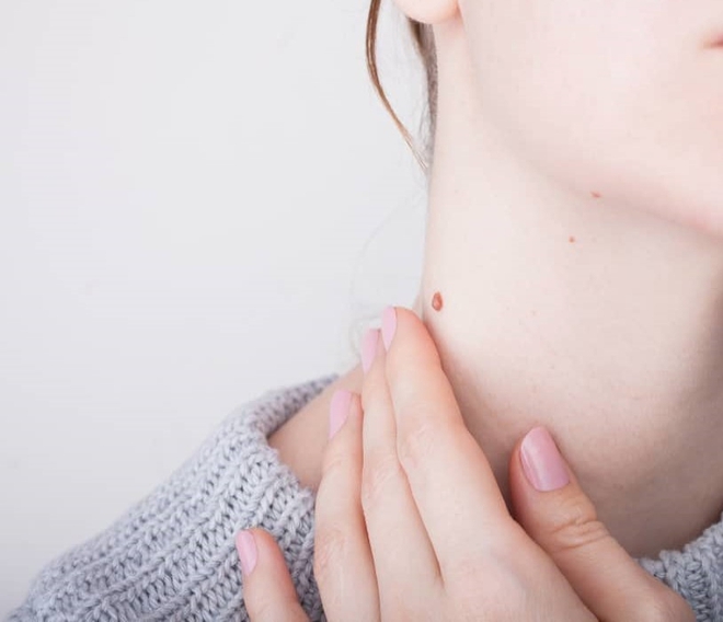 Tr&ecirc;n cổ c&oacute; 3 thay đổi n&agrave;y th&igrave; n&ecirc;n sớm đi tầm so&aacute;t ung thư - Ảnh 2.