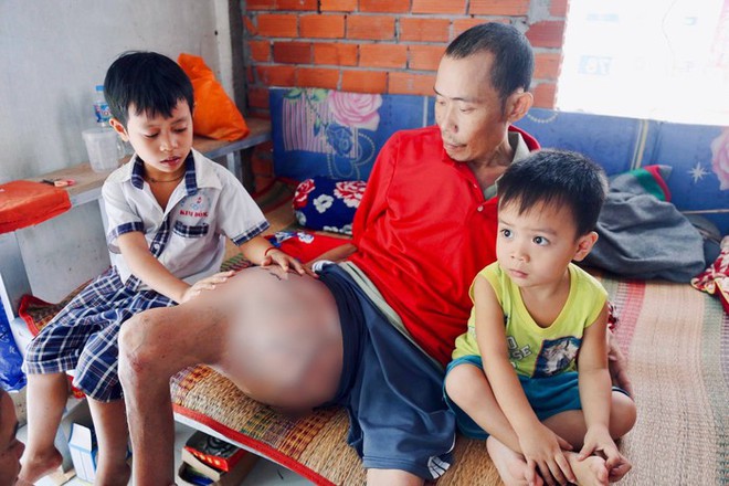Người cha ung thư xương, ước được sống để nh&igrave;n 3 đứa con nhỏ lớn l&ecirc;n - Ảnh 1.