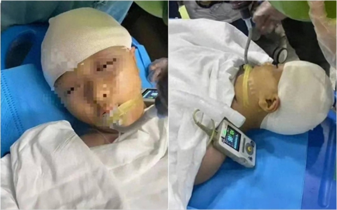 Vụ nữ sinh bị tác động vật lý đến mức vỡ hộp sọ: Quá khứ của thầy giáo bị vạch trần - Ảnh 1.