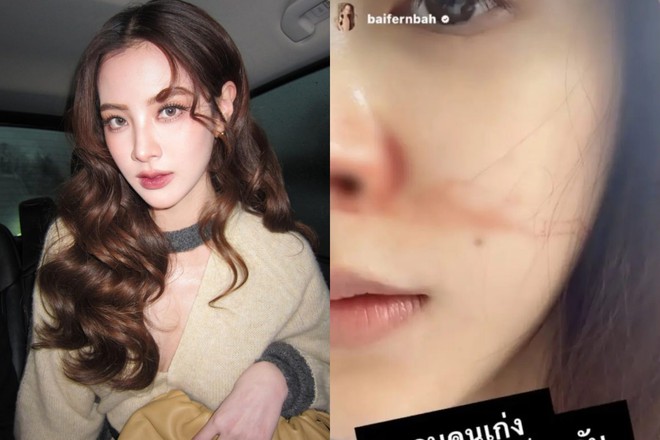 Baifern bất ngờ nhập viện truyền nước biển, bạn trai Nine Naphat lập tức c&oacute; động th&aacute;i đ&aacute;ng ch&uacute; &yacute; - Ảnh 5.