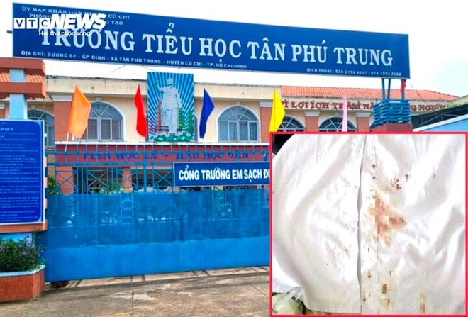 TP.HCM: Bị tố đ&aacute;nh học sinh chảy m&aacute;u đầu, hiệu trưởng tường tr&igrave;nh - Ảnh 1.