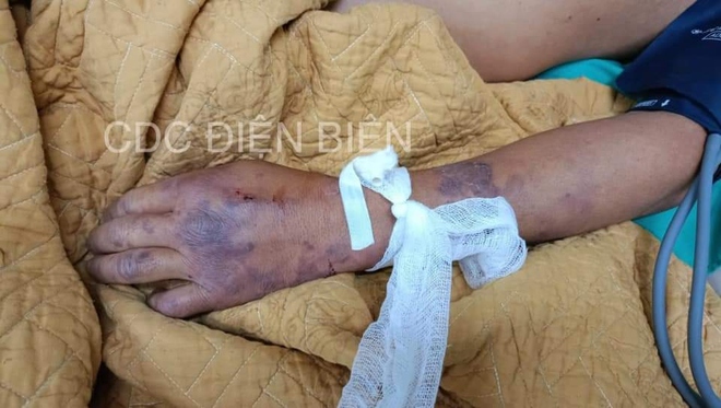 Ghi nhận 1 trường h…