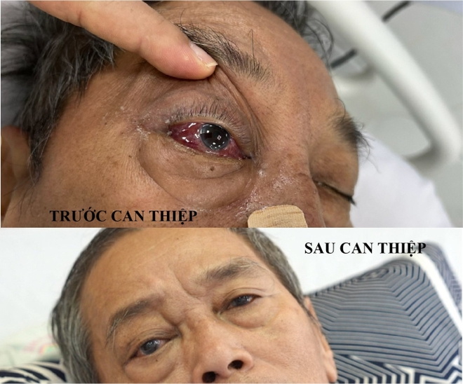 Thường xuy&ecirc;n bị đỏ mắt v&agrave; &ugrave; tai, người đ&agrave;n &ocirc;ng nhập viện trong t&igrave;nh trạng h&ocirc;n m&ecirc; s&acirc;u, phổi rất xấu - Ảnh 1.