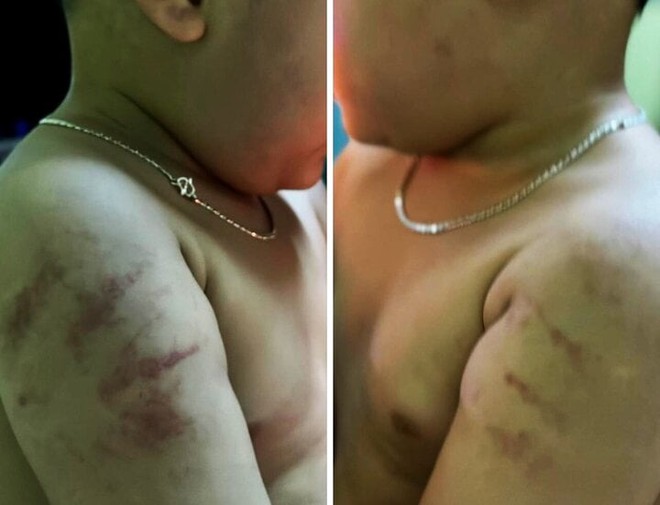 Xác minh thông tin 2 trẻ bị bạo hành tại cơ sở mầm non tư thục ở Bình Định - Ảnh 2.