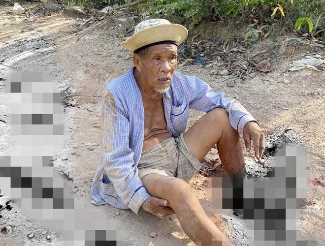 Điều tra vụ cụ ông 85 tuổi bị dập nát 2 bàn chân - Ảnh 1.