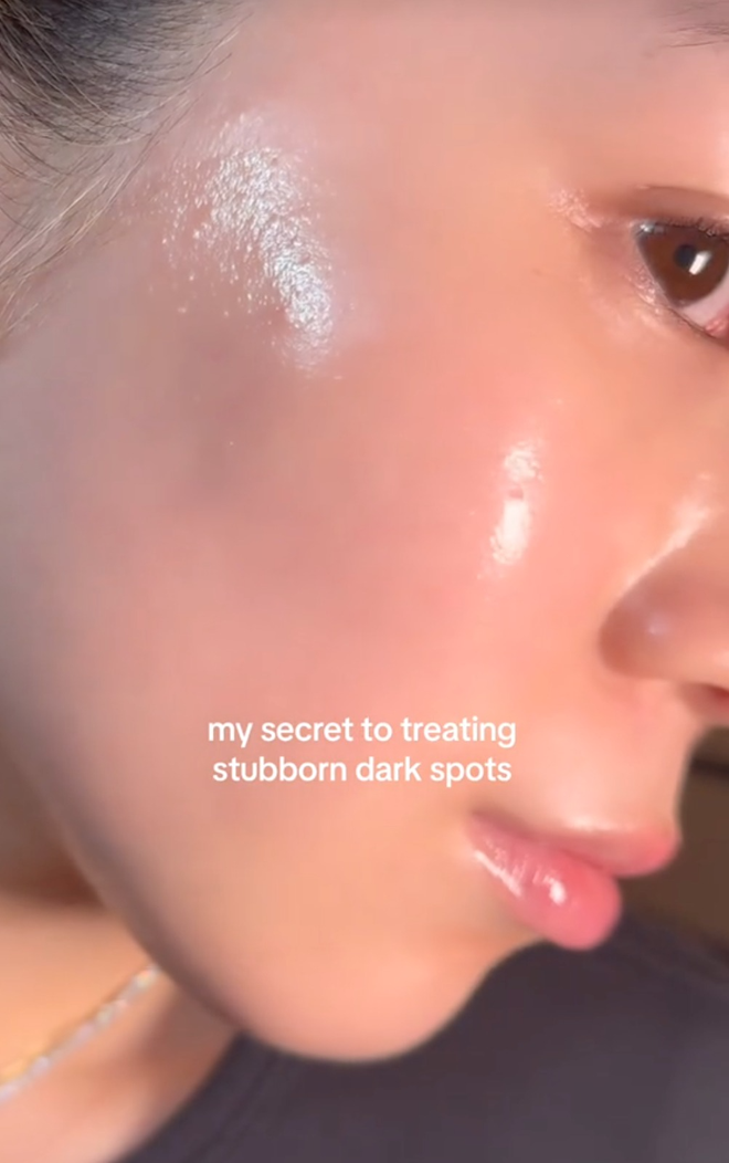 Beauty Blogger xứ Hàn review 3 lọ serum giá từ 300k giúp da tăng sinh collagen, chạm ngưỡng &quot;thủy tinh&quot; căng mướt - Ảnh 1.