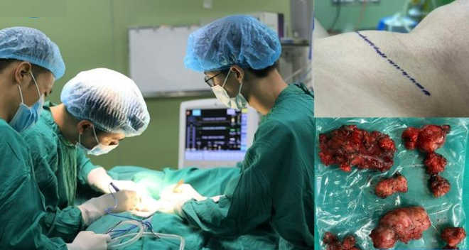 Vĩnh Phúc: Chàng trai phải cắt bỏ toàn bộ tuyến giáp vì ung thư sau khi có 2 dấu hiệu phổ biến nhiều người bỏ lỡ - Ảnh 1. Vĩnh Phúc: Chàng trai phải cắt bỏ toàn bộ tuyến giáp vì ung thư sau khi có 2 dấu hiệu phổ biến nhiều người bỏ lỡ - Ảnh 1.