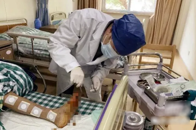 Ng&oacute;n ch&acirc;n người đ&agrave;n &ocirc;ng hoại tử đen s&igrave;, phải cắt bỏ cả b&agrave;n ch&acirc;n v&igrave; lỗi sai khi đi gi&agrave;y - Ảnh 1.