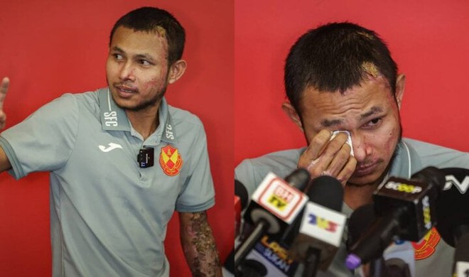 Ngôi sao tuyển Malaysia rơi nước mắt, hé lộ ý định giải nghệ sau khi bị tạt axit - Ảnh 1.