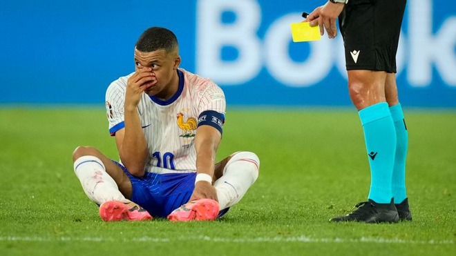 Trực tiếp Ph&aacute;p vs H&agrave; Lan: T&acirc;m điểm đổ dồn về ng&ocirc;i sao mặt nạ Mbappe - Ảnh 1.