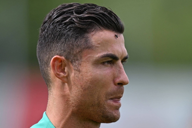 Xót xa trước tấm hình chụp cận cảnh gương mặt của Ronaldo tại Euro 2024: Huyền thoại cũng đã già! - Ảnh 1.