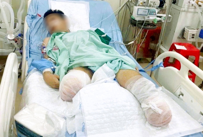 Xót xa gia cảnh của nam sinh bị tai nạn tàu hỏa phải cắt bỏ đôi chân trước kỳ thi tốt nghiệp THPT - Ảnh 1.
