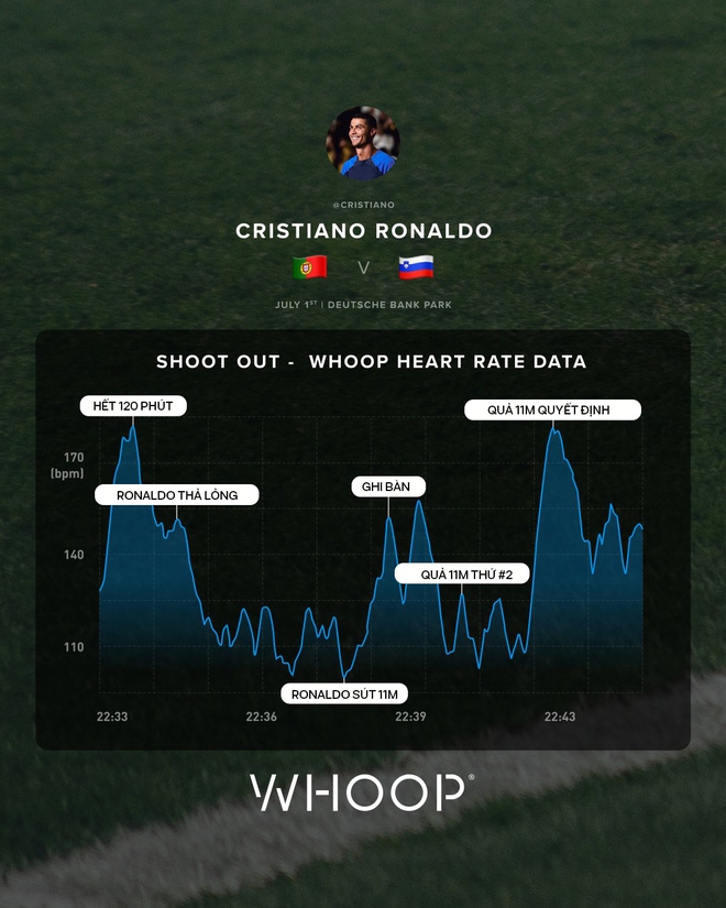Choáng với nhịp tim cao vùn vụt của Ronaldo trong trận đấu sinh tử tại Euro 2024: CR7 không ngờ cũng lo lắng đến vậy! - Ảnh 1.