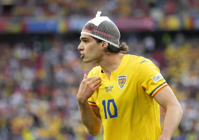 Vì sao cầu thủ Euro 2024 đội chiếc mũ đặc biệt trông như củ hành tây? - Ảnh 2.