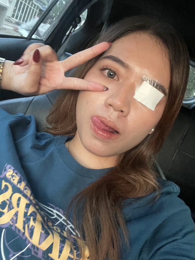 Phấn mắt PINKFLASH dính bê bối lớn: Người dùng bị lẹo mắt hàng loạt, hãng tiêu huỷ, đền tiền gấp đôi- Ảnh 1. Phấn mắt PINKFLASH dính bê bối lớn: Người dùng bị lẹo mắt hàng loạt, hãng tiêu huỷ, đền tiền gấp đôi- Ảnh 1.