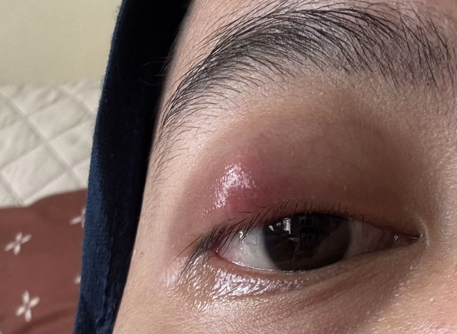 Phấn mắt PINKFLASH dính bê bối lớn: Người dùng bị lẹo mắt hàng loạt, hãng tiêu huỷ, đền tiền gấp đôi- Ảnh 4. Phấn mắt PINKFLASH dính bê bối lớn: Người dùng bị lẹo mắt hàng loạt, hãng tiêu huỷ, đền tiền gấp đôi- Ảnh 4.