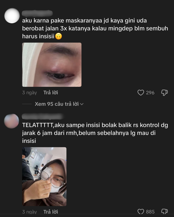 Phấn mắt PINKFLASH dính bê bối lớn: Người dùng bị lẹo mắt hàng loạt, hãng tiêu huỷ, đền tiền gấp đôi- Ảnh 12. Phấn mắt PINKFLASH dính bê bối lớn: Người dùng bị lẹo mắt hàng loạt, hãng tiêu huỷ, đền tiền gấp đôi- Ảnh 12.