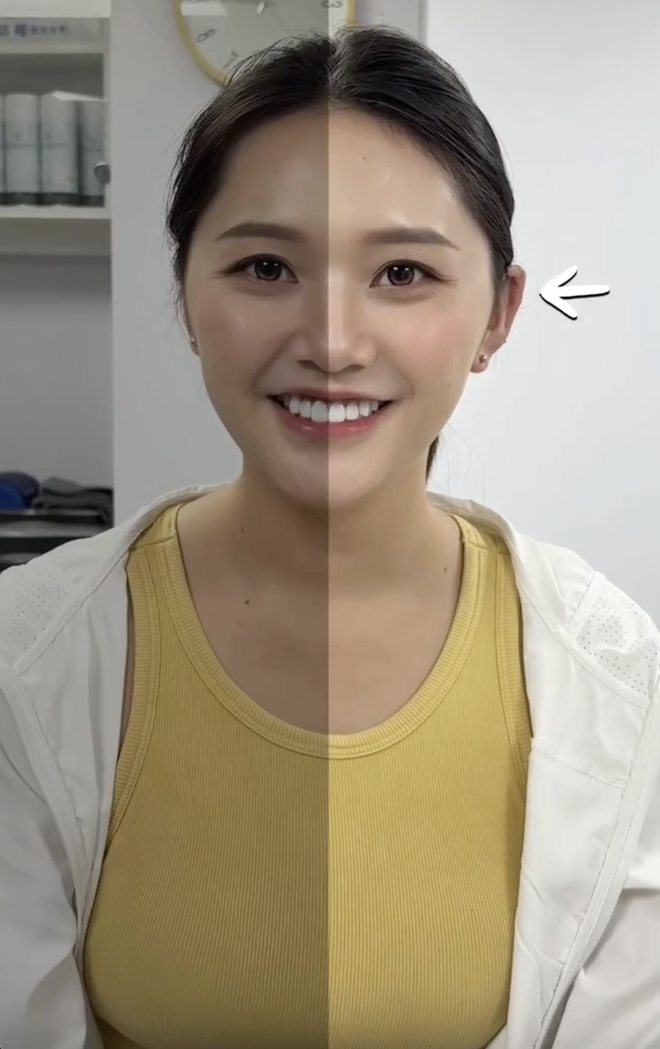 Cô gái khổ sở 30 năm vì tai giống Đoàn Di Băng- Ảnh 2. Cô gái khổ sở 30 năm vì tai giống Đoàn Di Băng- Ảnh 2.