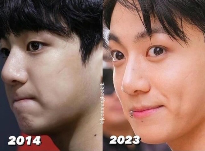 Jungkook để lộ sụn mũi khi dự show thời trang?- Ảnh 8.