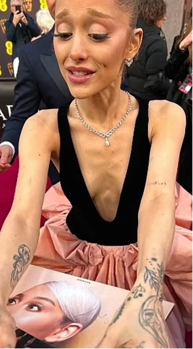 Từ "g&aacute;i chiến" slay tưng bừng, nữ ca sĩ từng b&ugrave;ng k&egrave;o fan Việt 8 năm trước nay hốc h&aacute;c đến trơ xương- Ảnh 13.