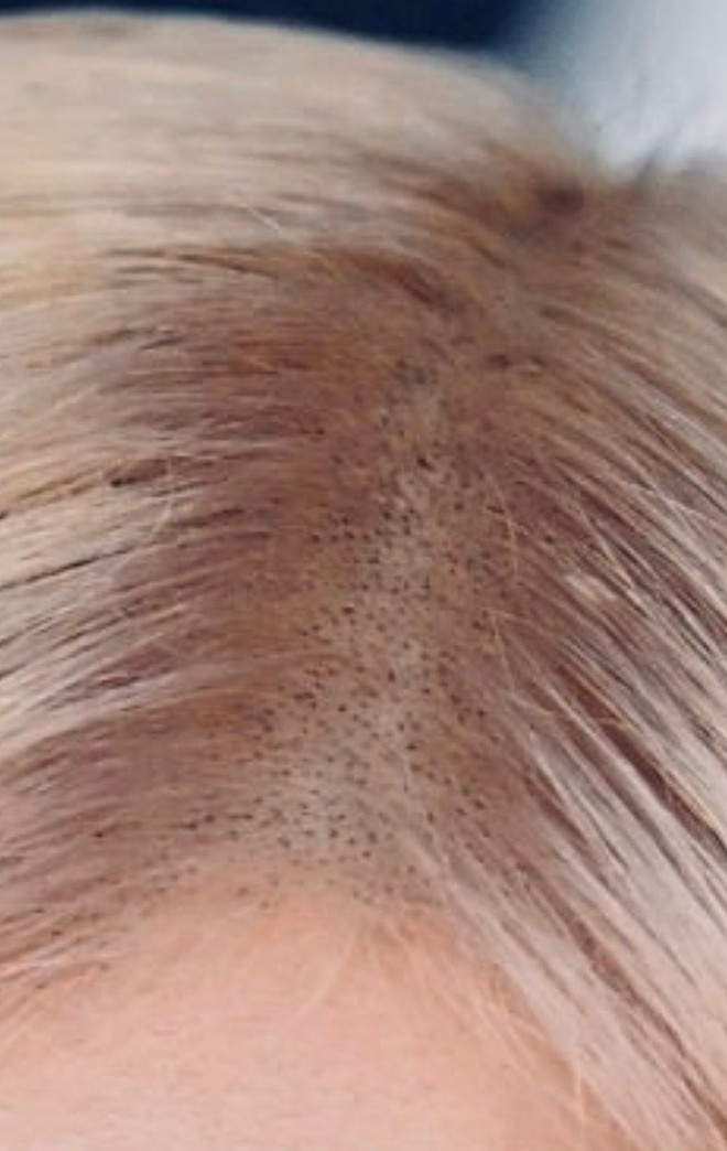 Rộ tranh c&atilde;i Ros&eacute; để t&oacute;c đen đẹp hơn t&oacute;c v&agrave;ng, nhưng c&oacute; một l&yacute; do khiến c&ocirc; kh&oacute; &ldquo;quay xe&rdquo;- Ảnh 14.