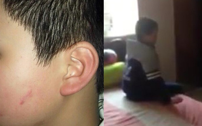 Hà Nội: Nghi học sinh lớp 4 bị cô giáo cho 42 bạn cùng lớp tát vào mặt?