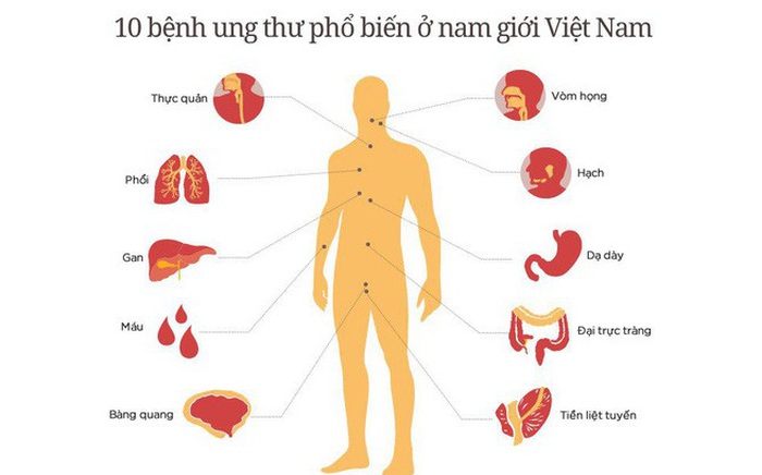 Mỗi năm VN có hơn 126.000 người mắc ung thư: Chuyên gia "tiết lộ" 3 thủ phạm gây bệnh