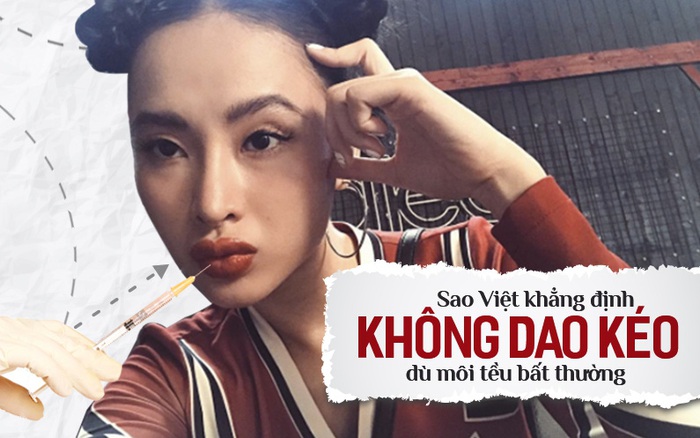 Rõ ràng là môi tều thế kia mà sao Việt nào cũng "chối đây đẩy" khi dính nghi vấn đụng chạm dao kéo