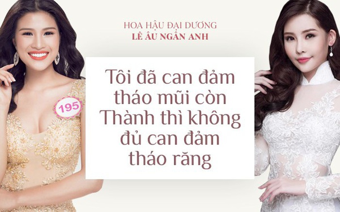 Hoa hậu Ngân Anh: "Tôi can đảm tháo sụn mũi còn Nguyễn Thị Thành không tháo răng nên không thể so sánh được"