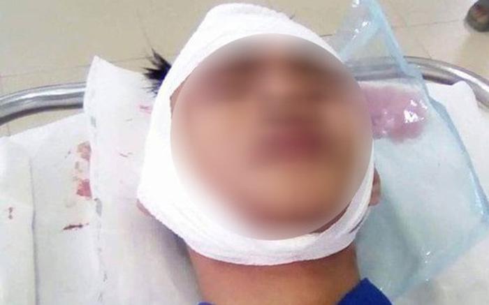 Nhóm thanh niên thấy người là chém khiến người dân Đồng Nai hoang mang