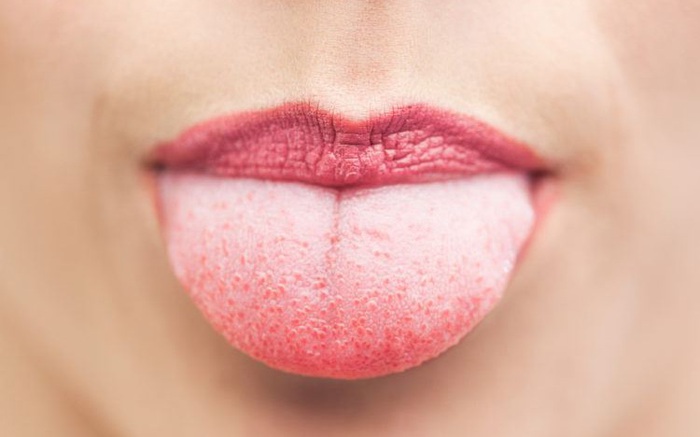 Bạn sẽ không biết rằng mình đang bị thiếu máu cho tới khi nhận ra mình có những dấu hiệu này