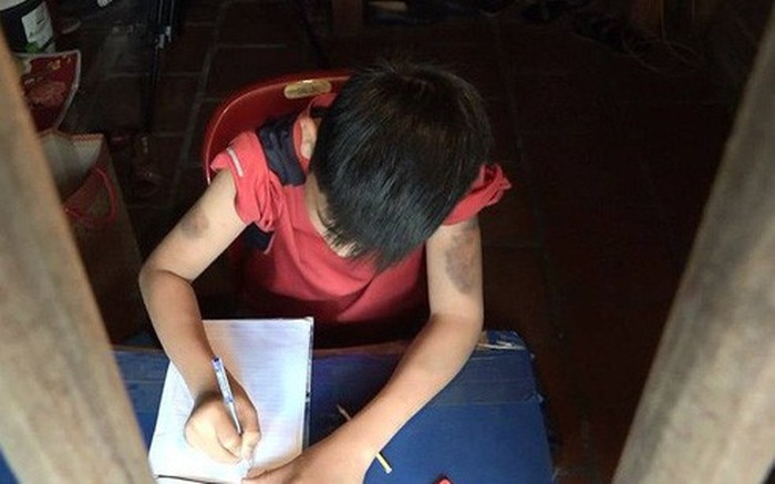Người nhà bé trai bị bạo hành nói bố đẻ, mẹ kế không cho tiếp xúc với ai