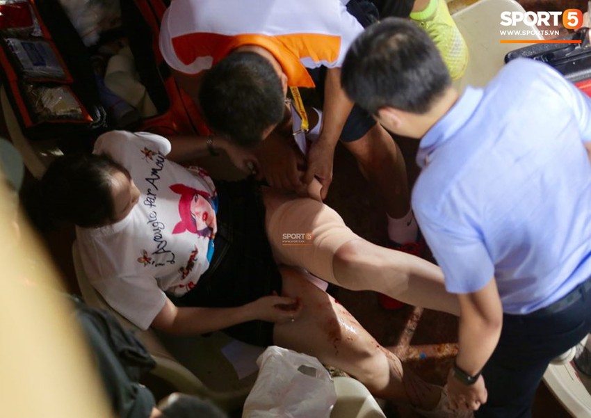 Fan nữ đổ máu vì bị pháo bắn trúng trên khán đài trận Hà Nội FC vs Nam Định - Ảnh 3.
