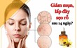Kết quả cực bất ngờ với trải nghiệm serum giảm mụn, lấp đầy sẹo rỗ Derladie chỉ trong 14 ngày