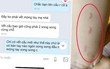 Bé mẫu giáo đi học về tay xuất hiện đầy vết bấm móng tay, nhà trường có bài giải thích khiến mẹ bức xúc vì sai sự thật?