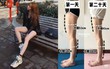 Nói tạm biệt với chân 