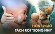 ẢNH: Khoảnh khắc xúc động trong suốt 12 tiếng phẫu thuật giúp Trúc Nhi - Diệu Nhi có được hình hài nguyên vẹn